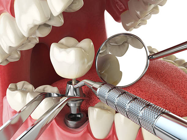 Best Emergency Dentist for Special Needs Patients in Aquia Harbour, VA